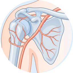 Shoulder Embolization